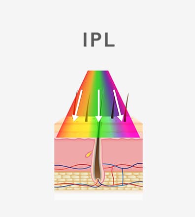 IPL — scattered light approach